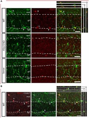 Disruption of the Microglial ADP Receptor P2Y13 Enhances Adult Hippocampal Neurogenesis